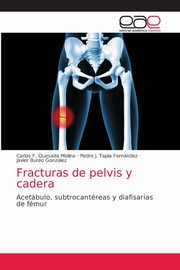 Fracturas de pelvis y cadera, Quesada Molina Carlos F.