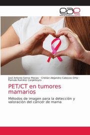 PET/CT en tumores mamarios, Serna Macias Jos Antonio