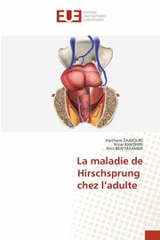 ksiazka tytu: La maladie de Hirschsprung chez l'adulte autor: ZAAFOURI Haithem