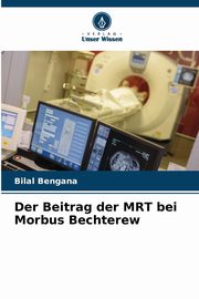 Der Beitrag der MRT bei Morbus Bechterew, Bengana Bilal