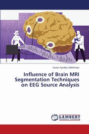 Influence of Brain MRI Segmentation Techniques on Eeg Source Analysis, Adebimpe Azeez Ayodeji