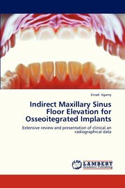 Indirect Maxillary Sinus Floor Elevation for Osseoitegrated Implants, Agamy Emad