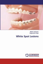 White Spot Lesions, Lakhanam Medha