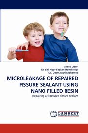 Microleakage of Repaired Fissure Sealant Using Nano Filled Resin, Qadri Ghalib