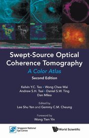 Swept-Source Optical Coherence Tomography, Teo Kelvin Y C