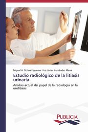 Estudio radiolgico de la litiasis urinaria, Ochoa Figueroa Miguel A.