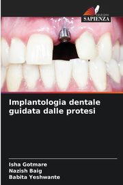 Implantologia dentale guidata dalle protesi, Gotmare Isha