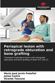 Periapical lesion with retrograde obturation and bone grafting, Jarrn Pe?afiel Mara Jos