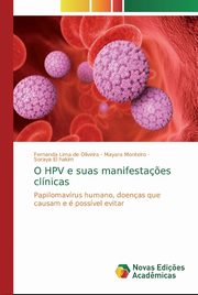 O HPV e suas manifesta?es clnicas, Lima de Oliveira Fernanda