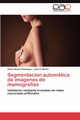 Segmentacin automtica de imgenes de mamografas, Novoa Velazquez Andra